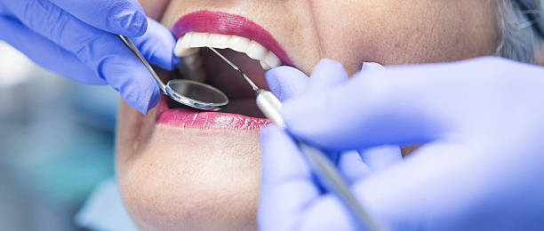 Best Emergency Broken Tooth Repair in Scott Af, IL