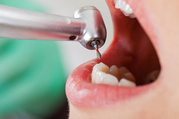 Best Emergency Treatment for Toothache in Scott Af, IL